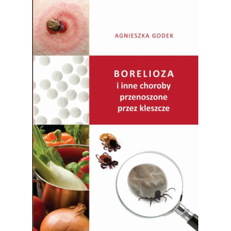 "Borelioza i inne choroby przenoszone przez kleszcze" Agnieszka Godek